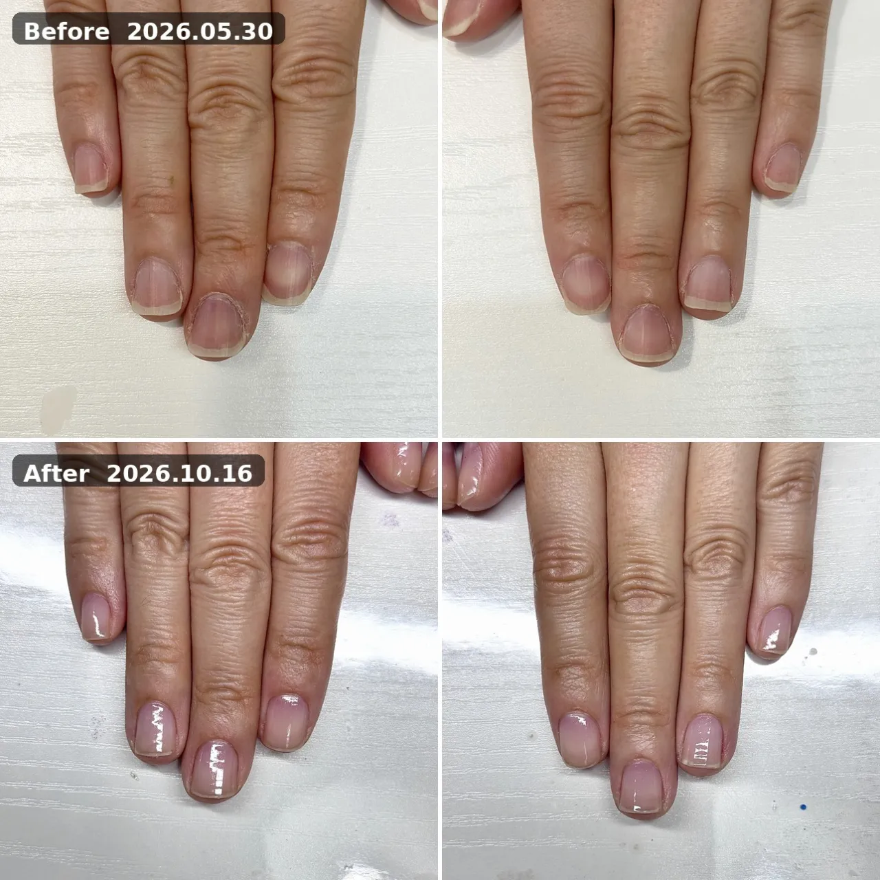 ビフォーアフター 2026.05.30→2026.10.16
