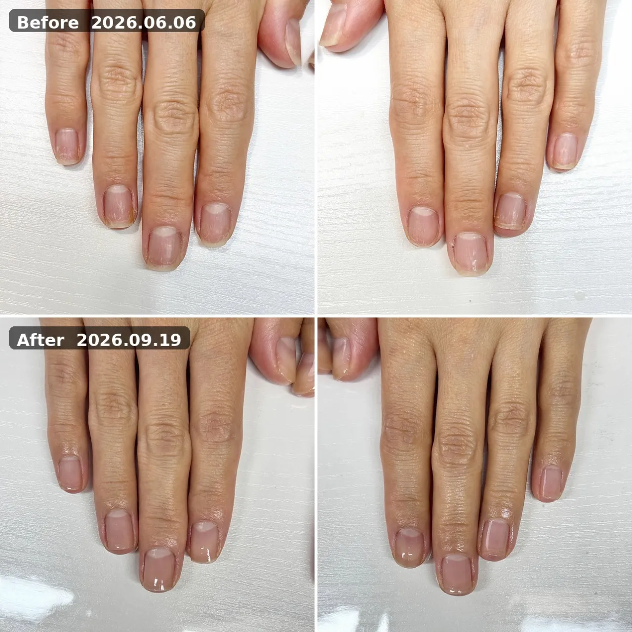 ビフォーアフター 2026.06.06→2026.09.19